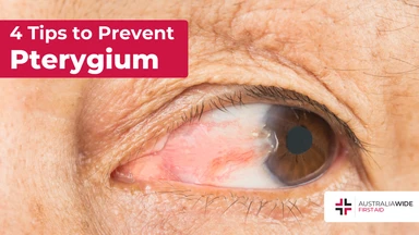 Prevent pterygium article header – First Aid Course Castle Hill Prevent pterygium article header – First Aid Article in Castle Hill